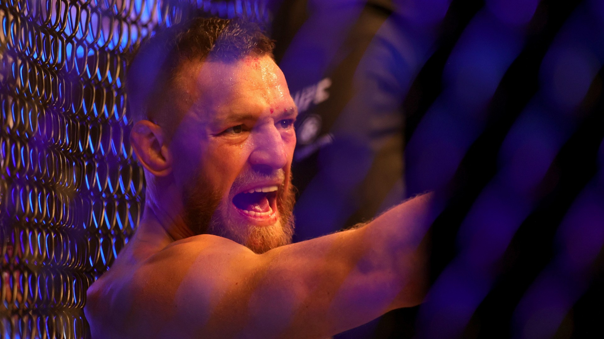 Conor McGregor injury update: When could MMA fighter return to Octagon? 1 Conor McGregor injury update: When could MMA fighter return to Octagon?