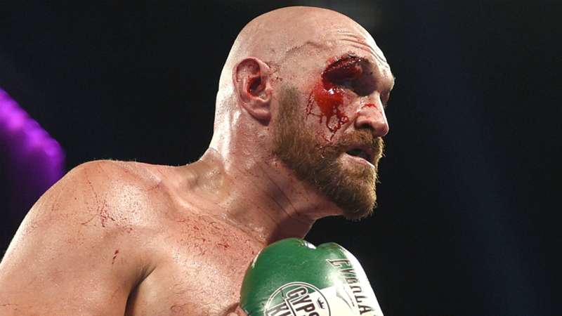 Tyson Fury Came Close To Facing Drew Mcintyre In A Wwe Pay Per View Event Dazn News Cambodia Tyson Fury Came Close To Facing Drew Mcintyre In A Wwe Pay Per View Event Dazn News Cambodia