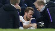 Harry Kane injury, Tottenham vs Man City, UCL 2018-19
