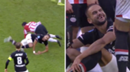 Pantelis Hatzidiakos AZ Alkmaar loses his teeth
