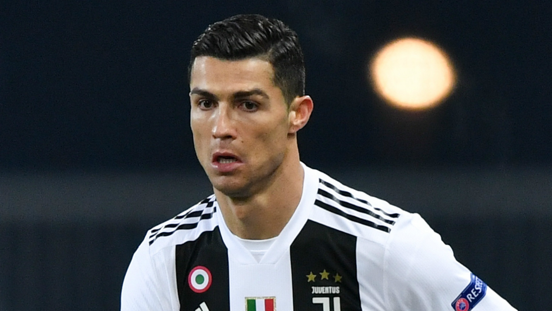 Cristiano Ronaldo Hair Transplant Clinic What Is It How