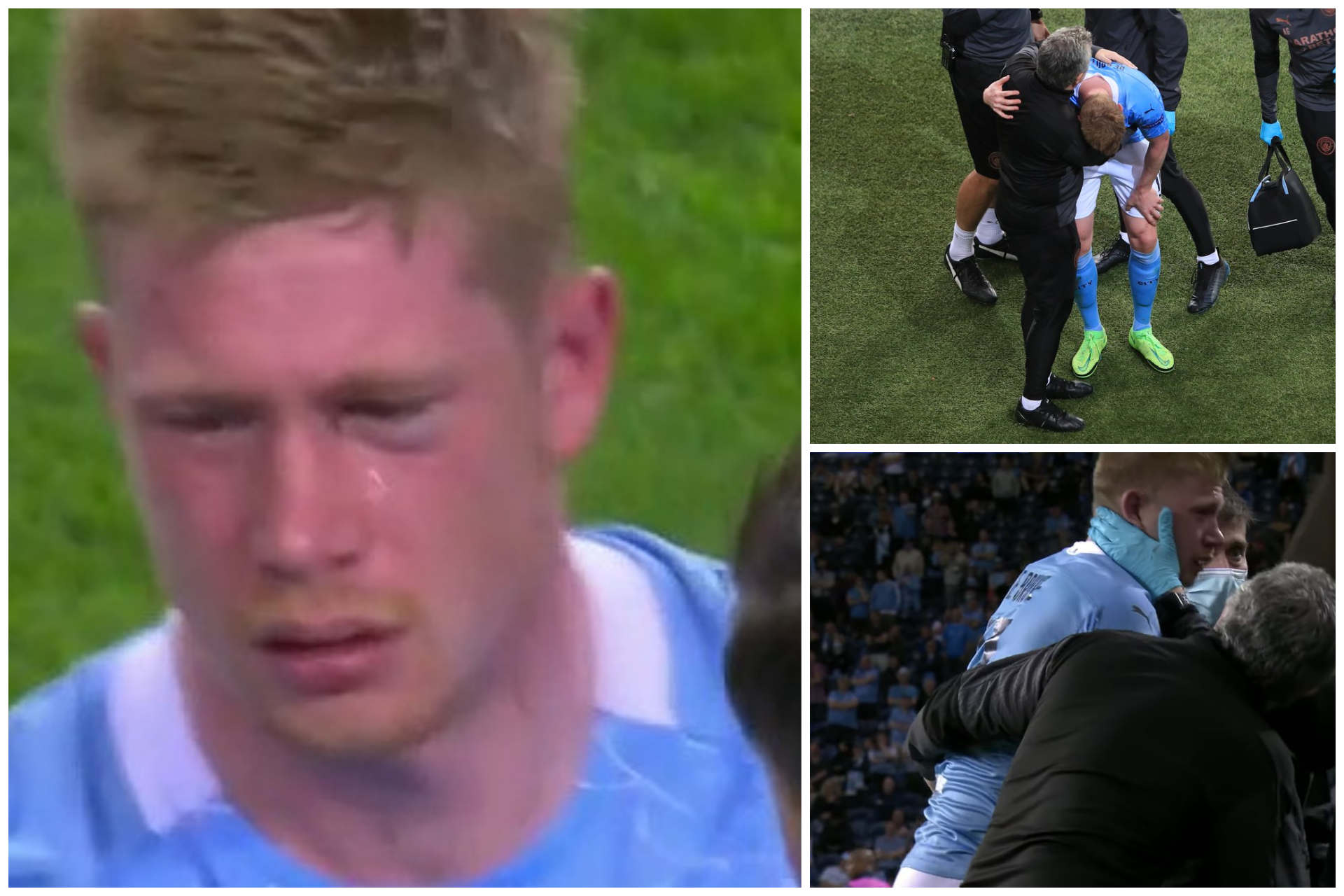De Bruyne Infortunio In Finale Frattura Orbitale E Al Naso Goal Com