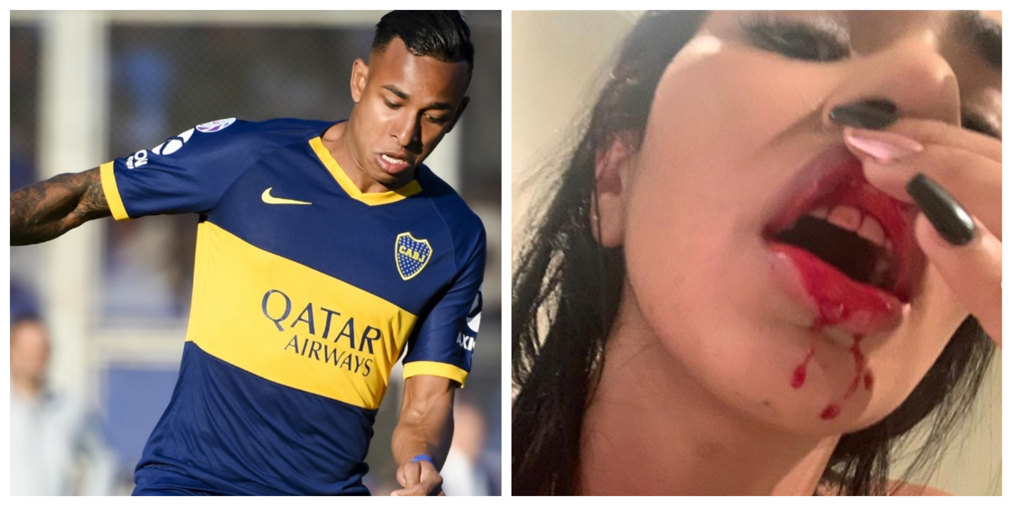 Los 14 Casos Mas Recientes De Violencia De Genero En El Futbol Argentino Goal Com By horhe | 8 january, 2018 no comments. casos mas recientes de violencia de