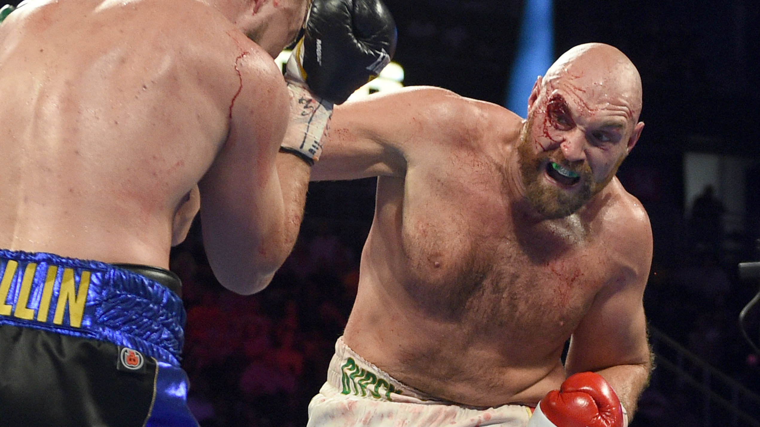 Heavyweight boxing champion Tyson Fury explains shocking ...