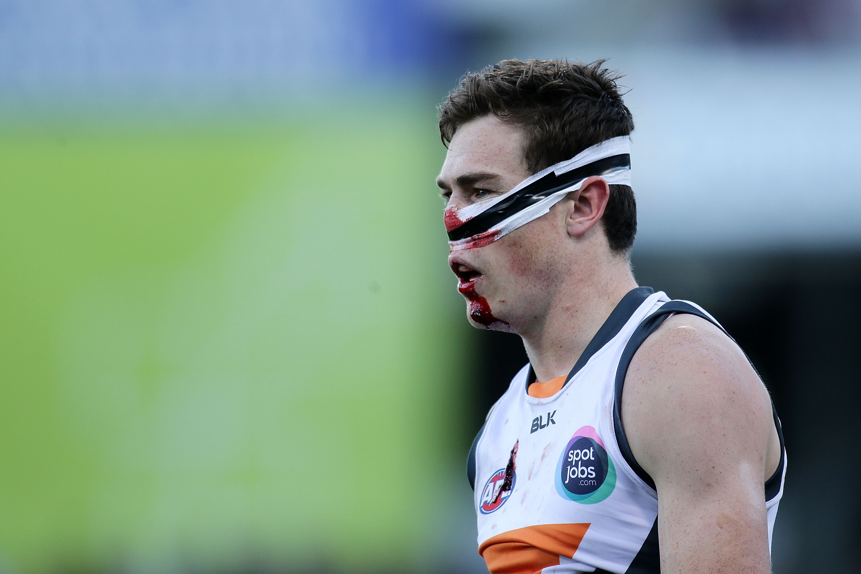 Five Head Injuries That Could Have Been Prevented Sporting News Australia