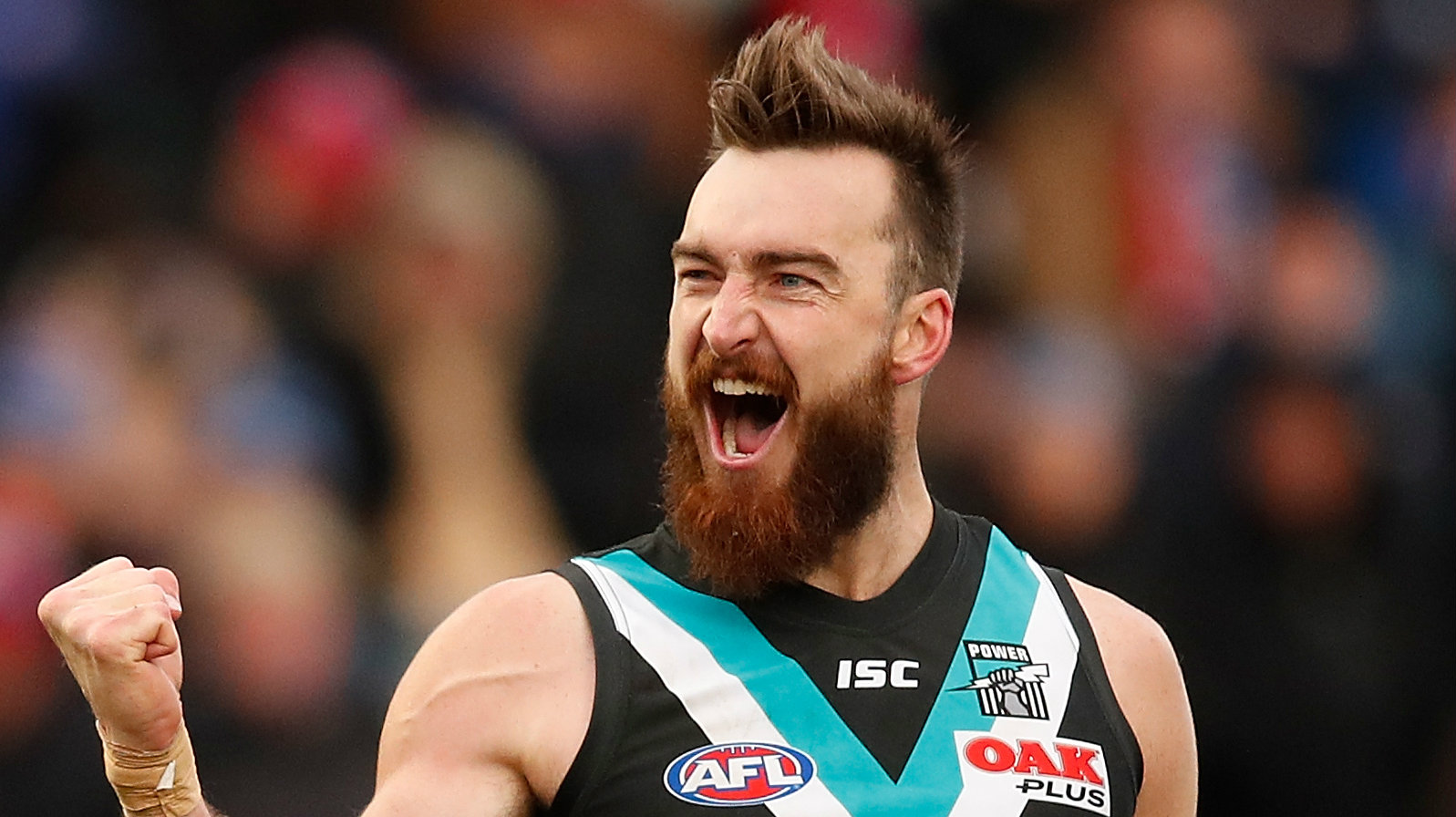 Charlie Dixon Injury Port Adelaide Big Man Undergoes More Surgery Sporting News Australia