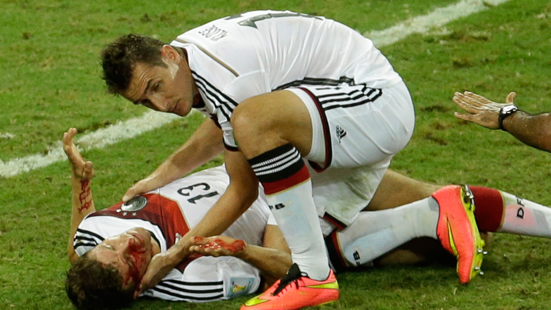 Germany S Muller All Bloody After Collision With Ghana Defender Sporting News