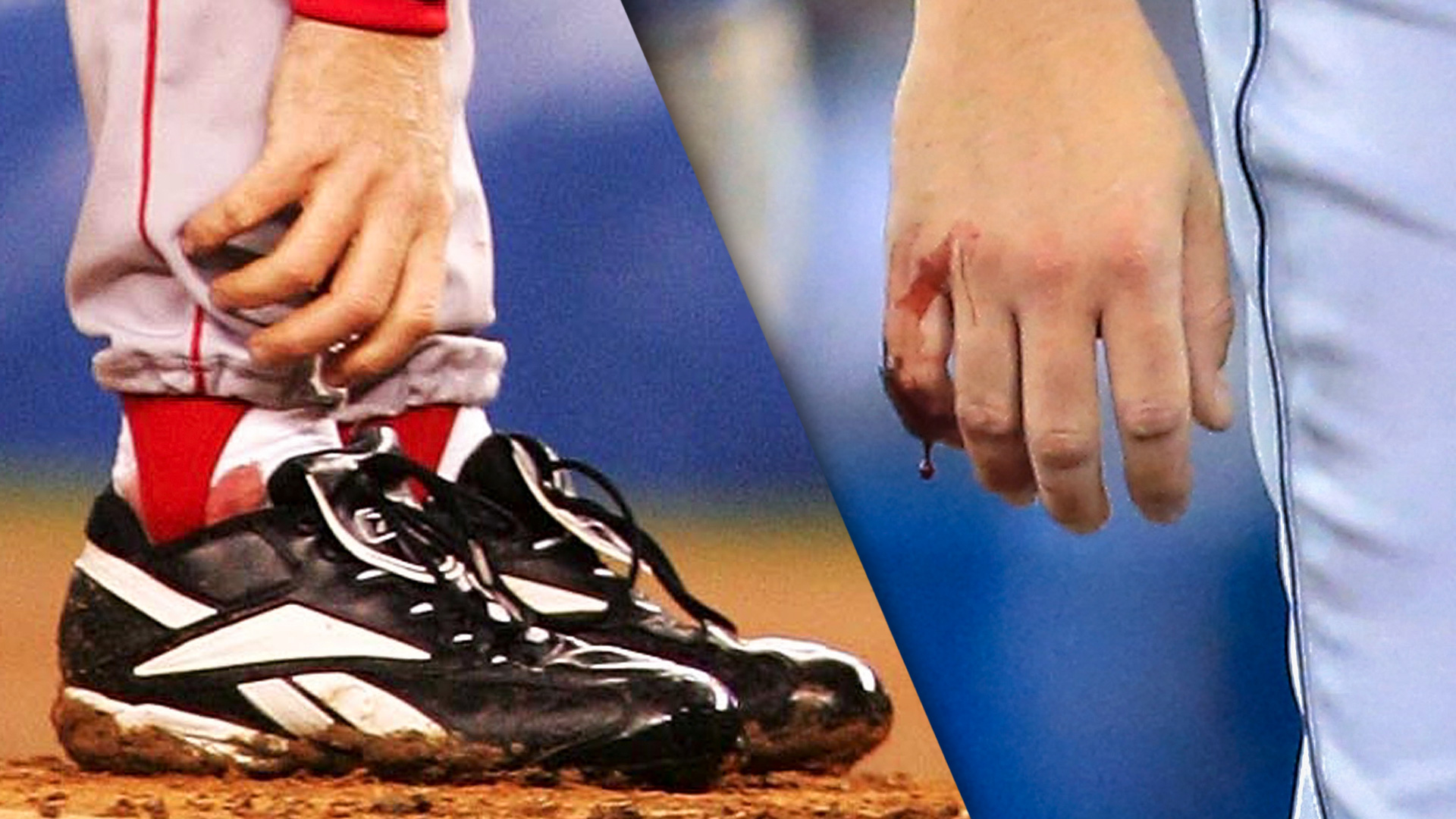 Unlike Curt Schilling Trevor Bauer Isn T A Jobless Has Been With Ketchup On His Sock Sporting News